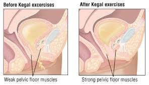 Kegel Exercises